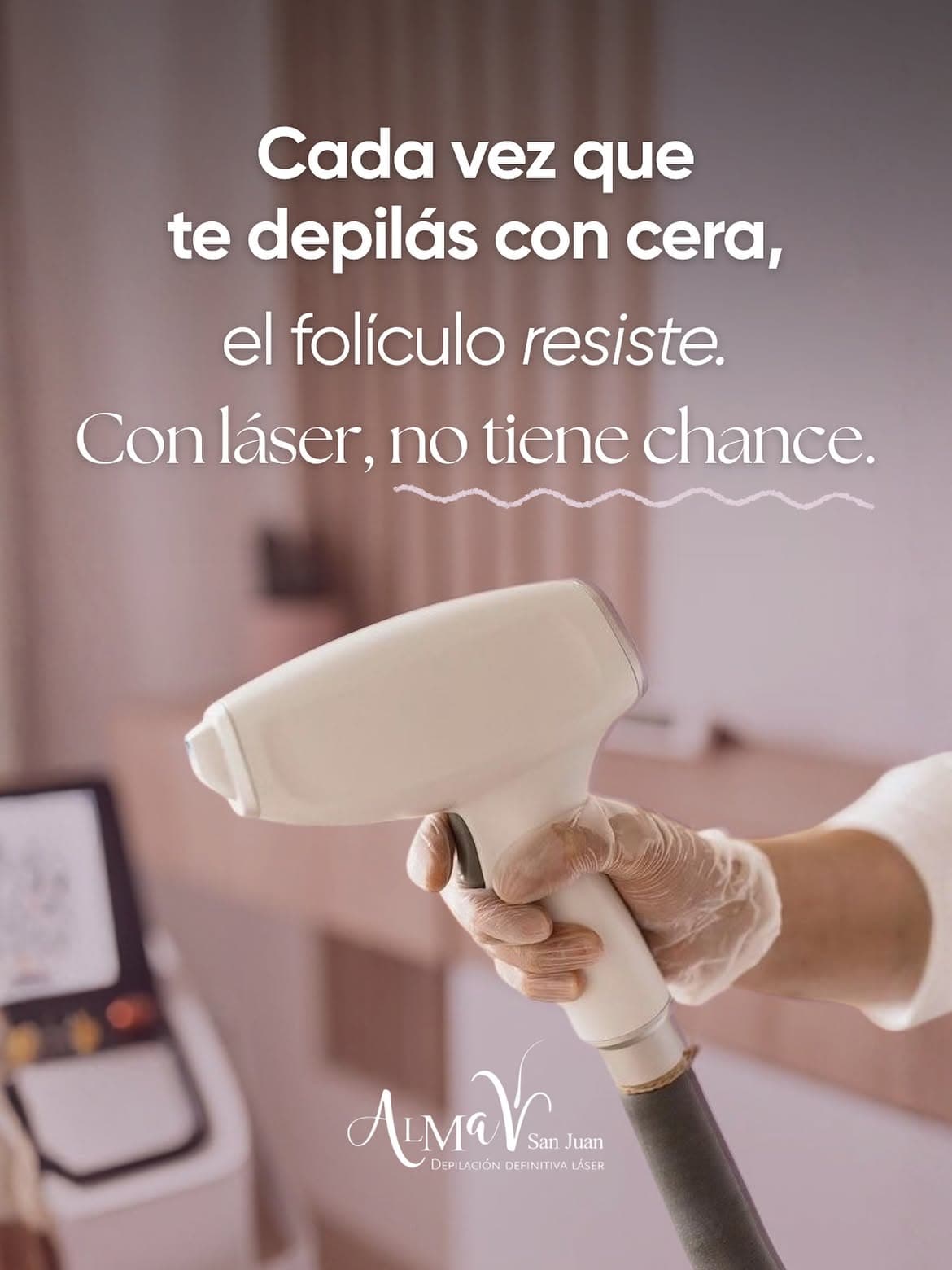 Cada vez que te depilás con cera, el folículo resiste. Con láser, no tiene chance — aplicación de Soprano ICE en Alma San Juan